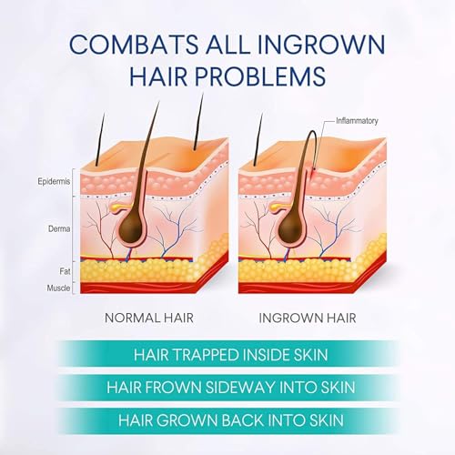 Razor Bumps & Ingrown Hair Treatment Serum for Face, Bikini, Underarm - Dinocook