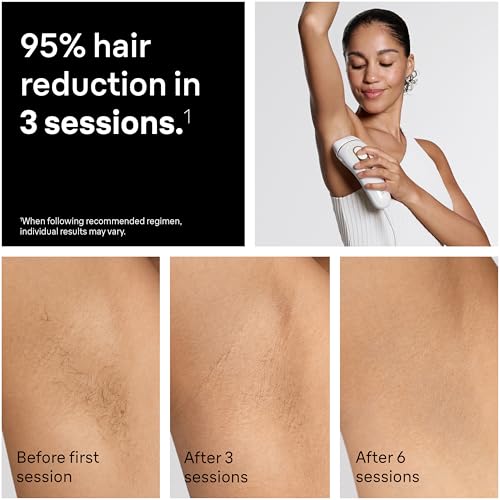 IPL Hair Removal Device for Women and Men - Permanent Laser & Light Treatment