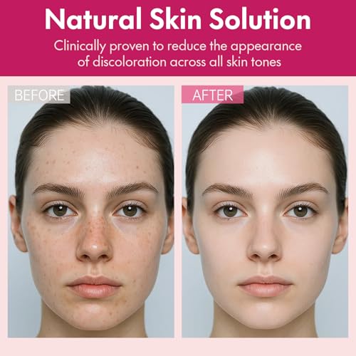 Arbutin 7% + Tranexamic Acid 4% Face Cream for Dark Spots & Uneven Skin Tone ? Hydrating, Non-Irritating, Safe for Sensitive Skin 1.76 oz (Pack of 1)