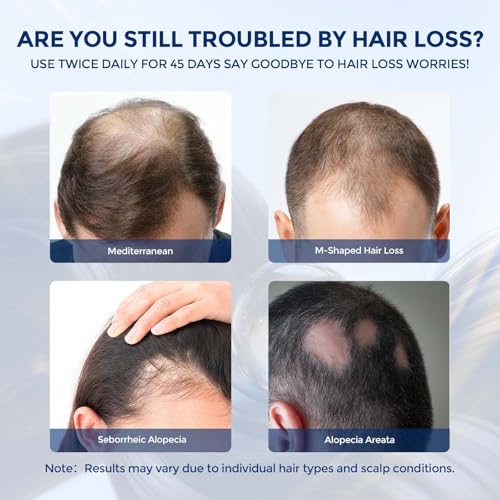 Hair Growth Spray with Biotin & Rosemary Oil for Women & Men
