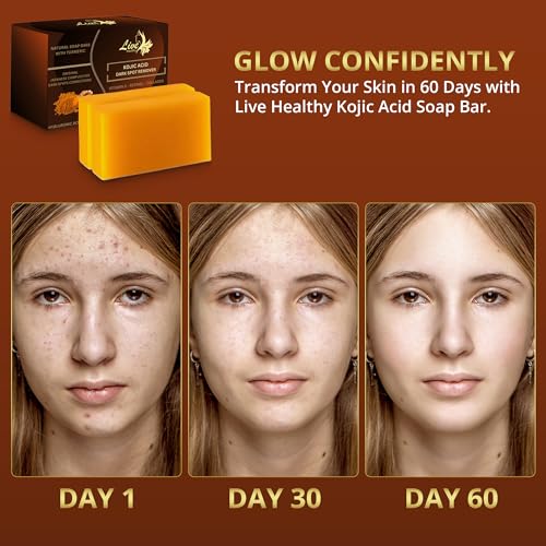 Live Healthy Kojic Acid Soap - Skin Brightening and Lightening for a Radiant Complexion - Natural, Gentle, Turmeric Soap Bar for Dark Spots, Uneven Skin Tone & Acne Scars - 2 Pack + Holder & Net