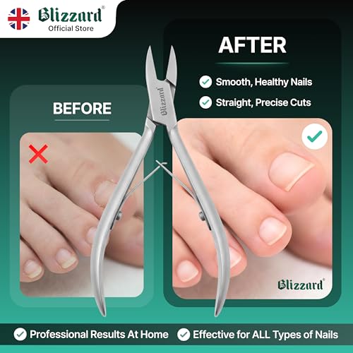 Ingrown Nail Clippers for Men with Ingrown Toenails ? Blizzard Podiatrist Toenail Clipper Set German Forged (13cm - Straight Head - Smooth)