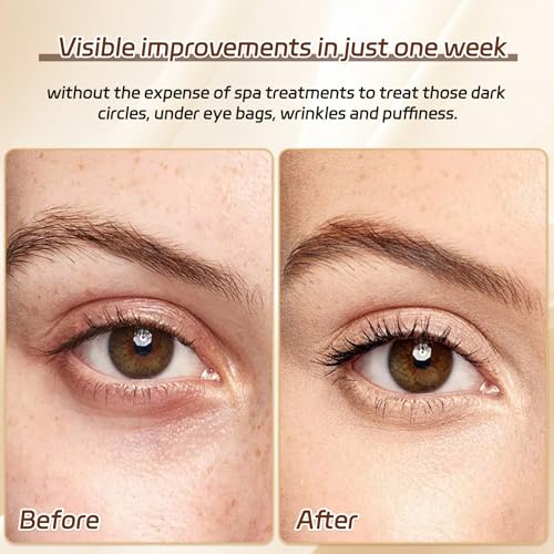 50 Pairs Under Eye Patches,24k Gold Gold Eye Mask,Eye Mask with Collagen,Eye Gel Pads for Puffy Eyes and Dark Circles,Reduces Wrinkles RevitalisesYour Skin, Skincare Treatment for Women Men