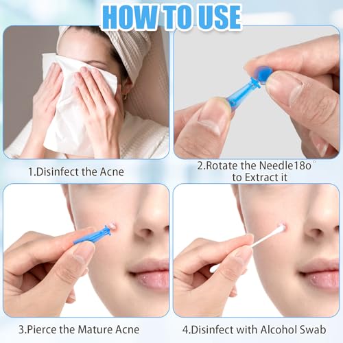 Sterile Lancets for Blackhead Removal, 100 Pack Pimple Needles