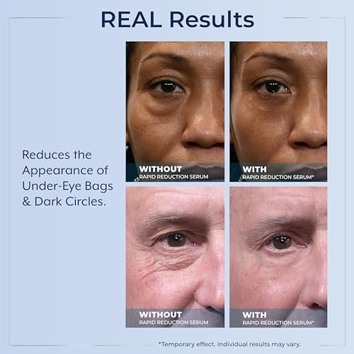 Plexaderm Rapid Reduction Eye Serum - 30 Single-Use Pods for Under-Eye Bags