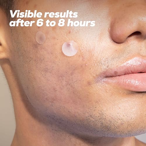 Hanhoo Men¡¯s Blemish Patch, 36 Count, with Tea Tree, Aloe, and Bamboo, Acne Spot Treatment, Soothes Skin, Invisible Pimple Patches, Korean Skincare