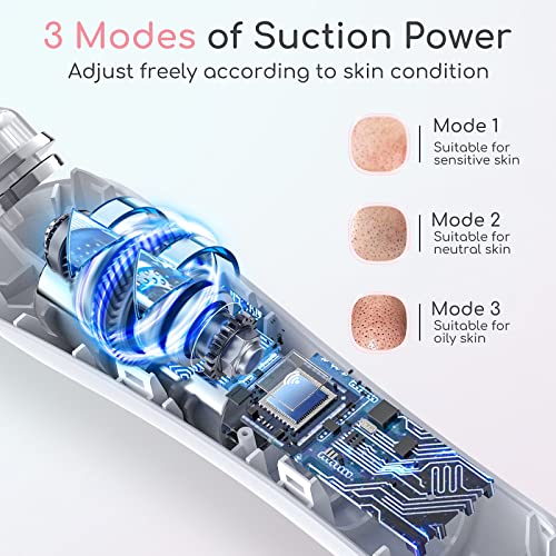 HD Camera Blackhead Remover Vacuum with LED Lighting - 3 Modes, 6 Suction Heads, Smartphone App