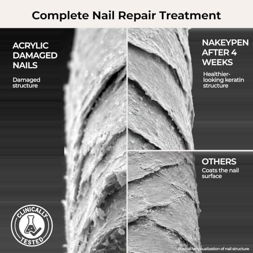 NakeyNails Complete Keratin Nail Repair Pen for Damaged Gel & Acrylic Nails