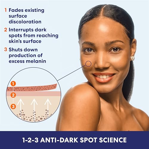 Palmer's Skin Success Anti-Dark Spot Fade Cream for Dry Skin, 4.4 Ounce
