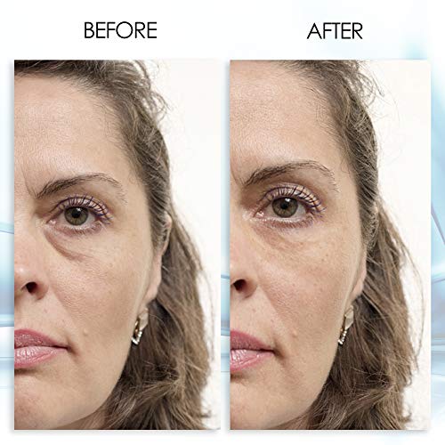 Puffy Eye Gel with Green Tea Extract - Instant Results