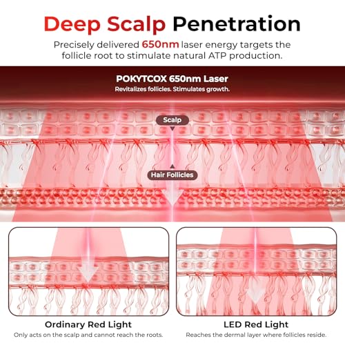 FDA Cleared Laser Hair Growth Helmet - 200 Diodes for Men & Women
