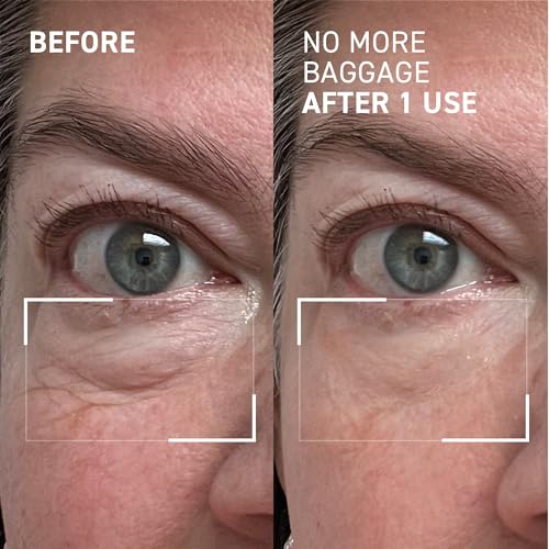 Dr. Brandt No More Baggage Eye Gel - Under-Eye Bags & Puffiness