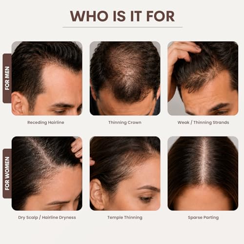 SØREN Micro Infusion Hair Renewal System with Peptide Serum
