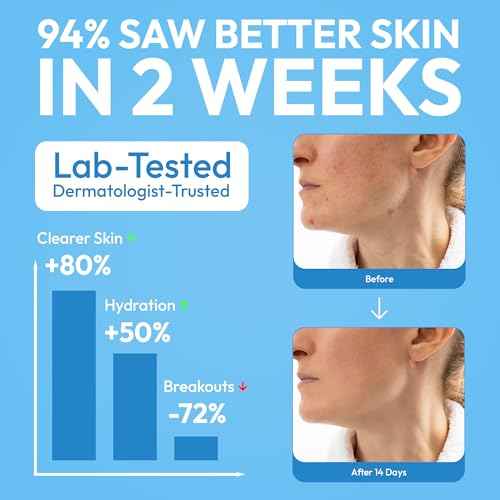 FOMIN Cleansing Facial Towel 50 Count - Disposable Face Towelette XL - Biodegradable, Ultra-soft, Plant Based & Tear-Resistant Face Cloths - Towels for Makeup Remover & Reduce Acne for Clearer Skin