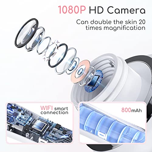 HD Camera Blackhead Remover Vacuum with LED Lighting - 3 Modes, 6 Suction Heads, Smartphone App