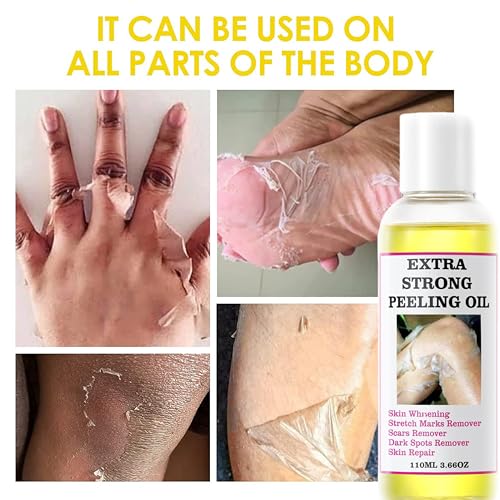 Yellow Peeling Oil - 330ML/10.98Fl Oz, Chemical Peel for Dark Skin, Exfoliating Body Oil for All Skin Types
