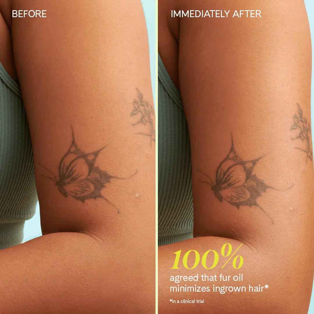 Ingrown Hair Oil for Bikini Line, Underarms, Legs & More – Soothes Razor Bumps, Prevents Ingrowns, Reduces Redness & Irritation – Jojoba, Clary Sage & Tea Tree – 14mL