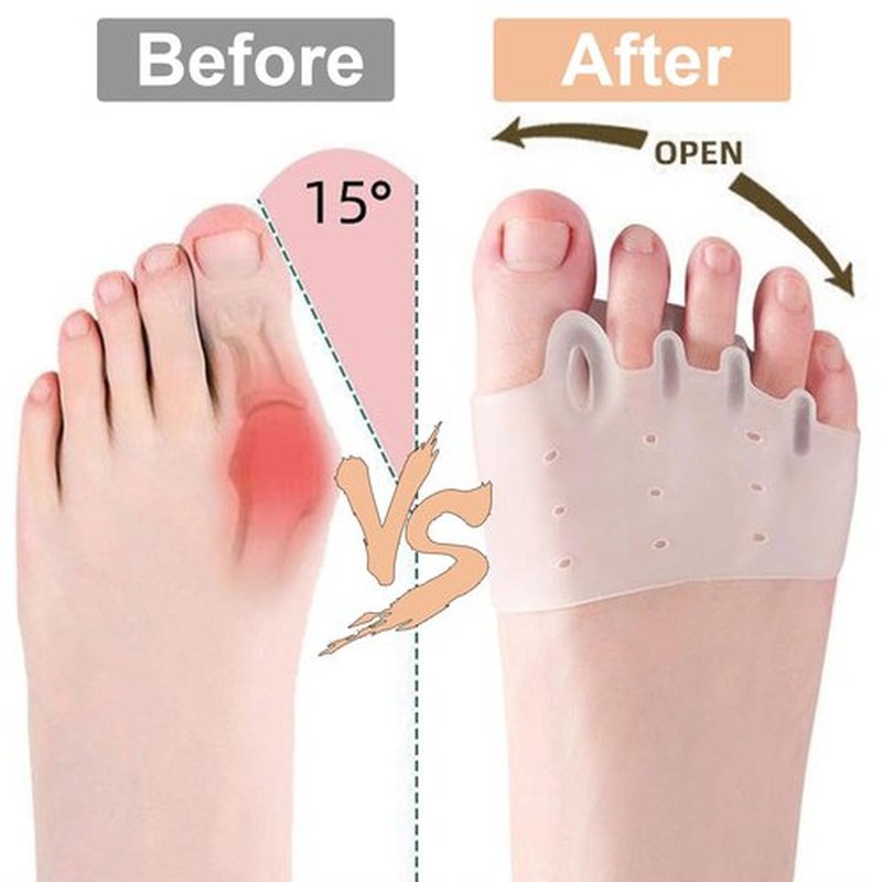 Hyggear Silicone Toe Separators For Women,Hygear Toe Separators For Women,Bunion Corrector,Toe Separators For Women,Breathable and Soft Toe Separators