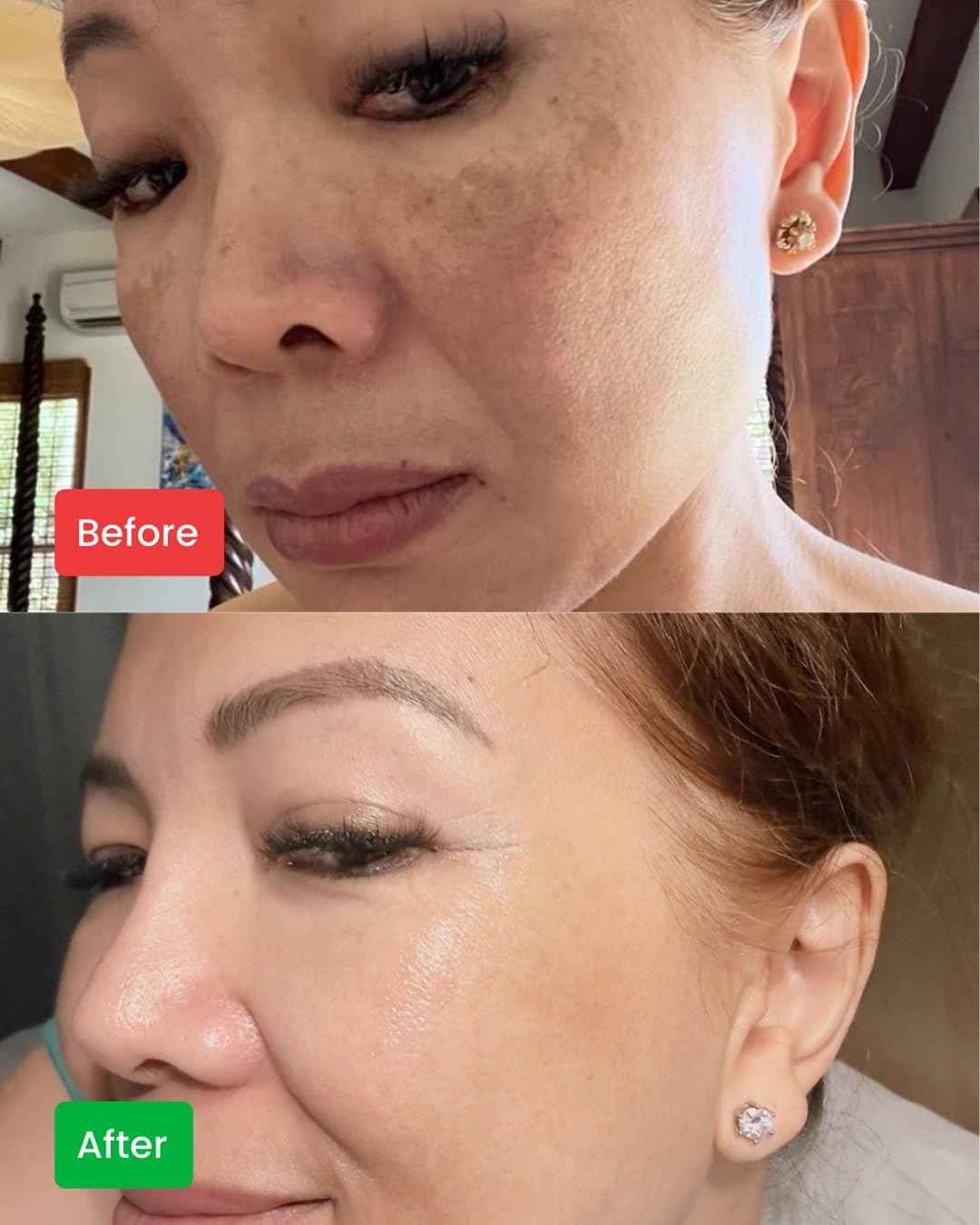 CHANVIDA Whitening Facial Cream 3-OETHYL Ascorbic Acid, Niacinamide, Hydoxypinacolone Retinoate, Ceramides, Plus Natural Ingredients Reduce Hyperpimentation, Dark Spots, Enlarged Pores & Fine Lines.