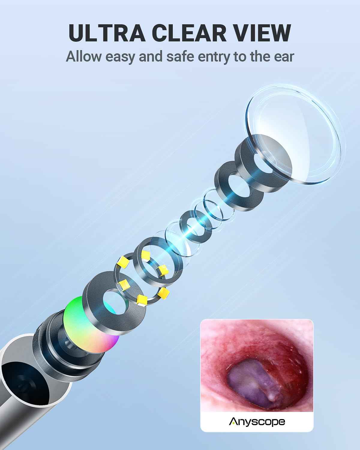 AnyScope HD Digital Otoscope, Video Ear Scope Otoscope with Light, Ultra Clear View Ear Camera with Ear Wax Removal Tools, Compatible with iPhone and Android Devices (Silver) ﻿