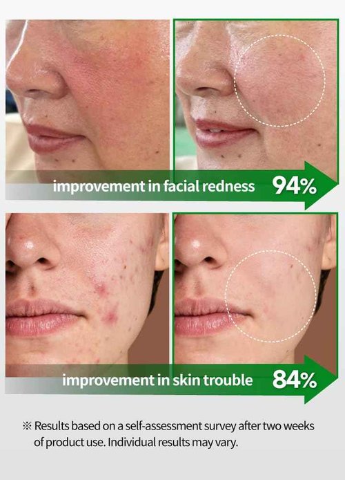 BEAUDIANI CICA Ampoule Toner Pads – 100 Pre-Soaked Facial Pads with Centella Asiatica, Hyaluronic Acid & Peptides | Korean Skincare for Sensitive Skin, Hydrating & Soothing