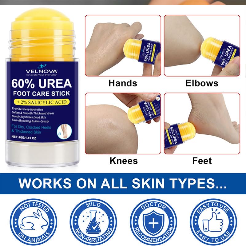 Velnova 60% Urea Foot Care Stick with 2% Salicylic Acid – Callus Remover & Intensive Moisturizer, 1.41 oz