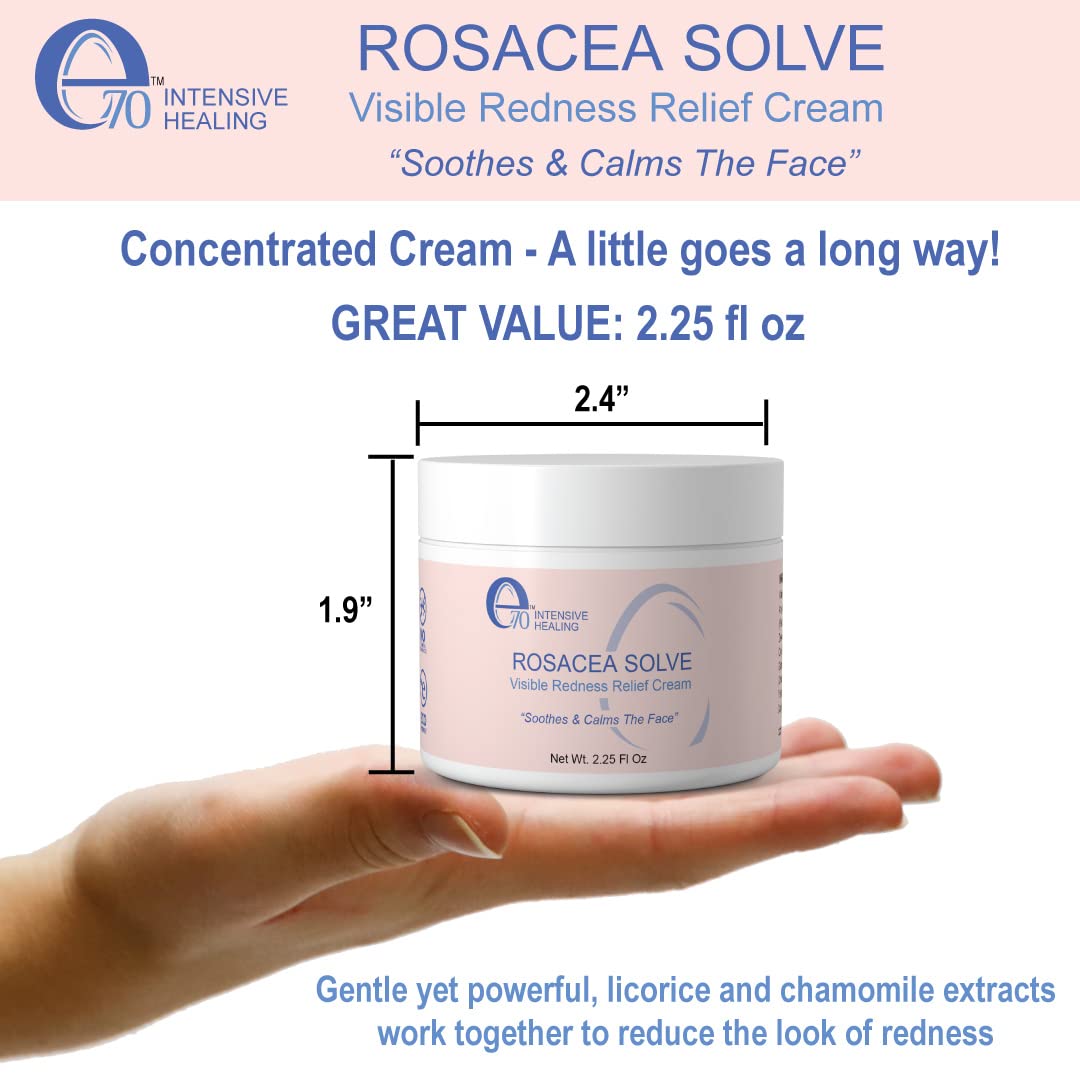 e70 Rosacea Solve - Redness Relief Cream - Face Moisturizer For Rosacea & Acne Prone Skin - Skin Care With Organic Ingredients, Almond Oil, Licorice and Chamomile Extracts - No Parabens (Pack of 2)