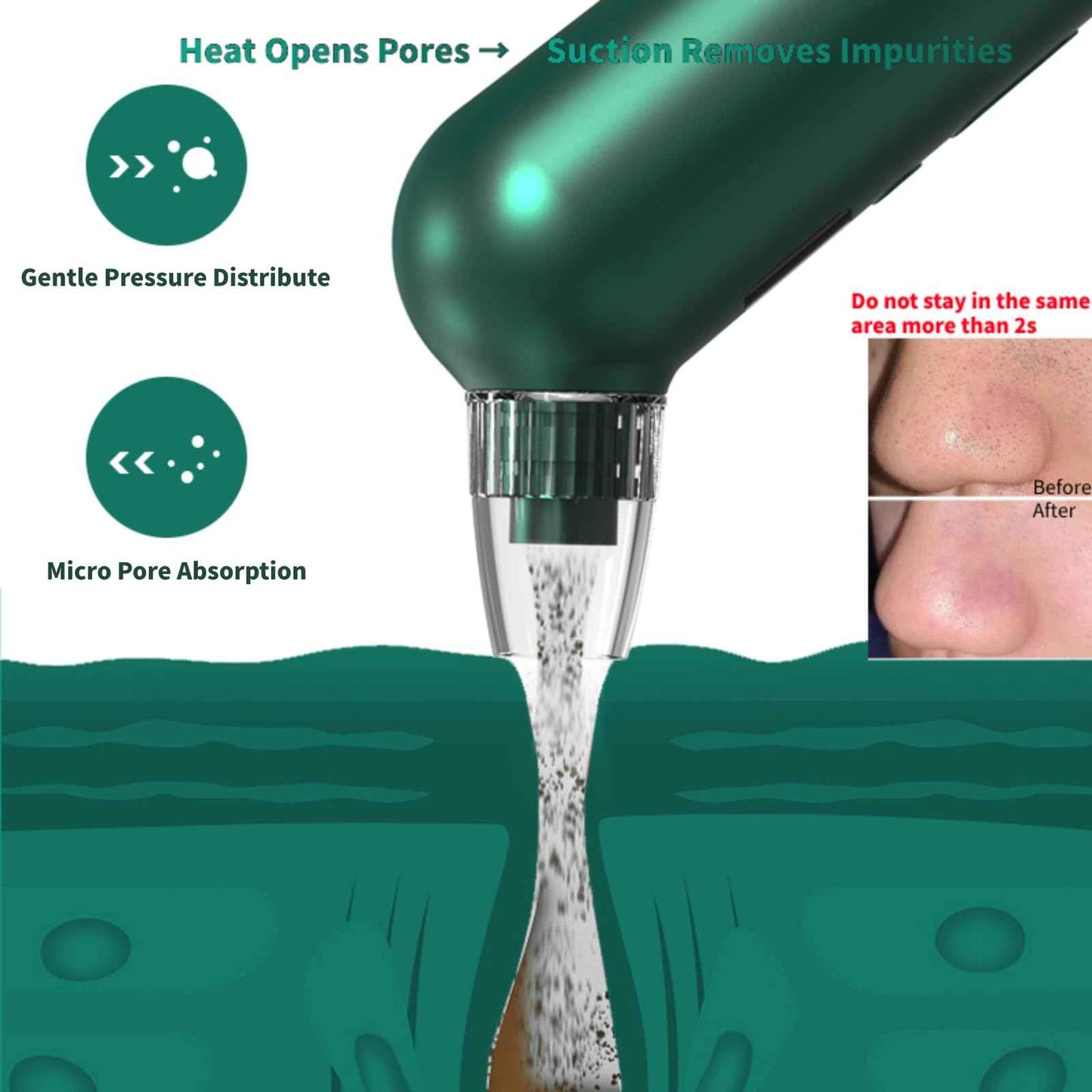 Blackhead Remover Pore Vacuum - 5 Suction Levels & 6 Attachments, Pore Vacuum with Heating (37-42°C), LCD Display, USB Rechargeable, Gift Ready