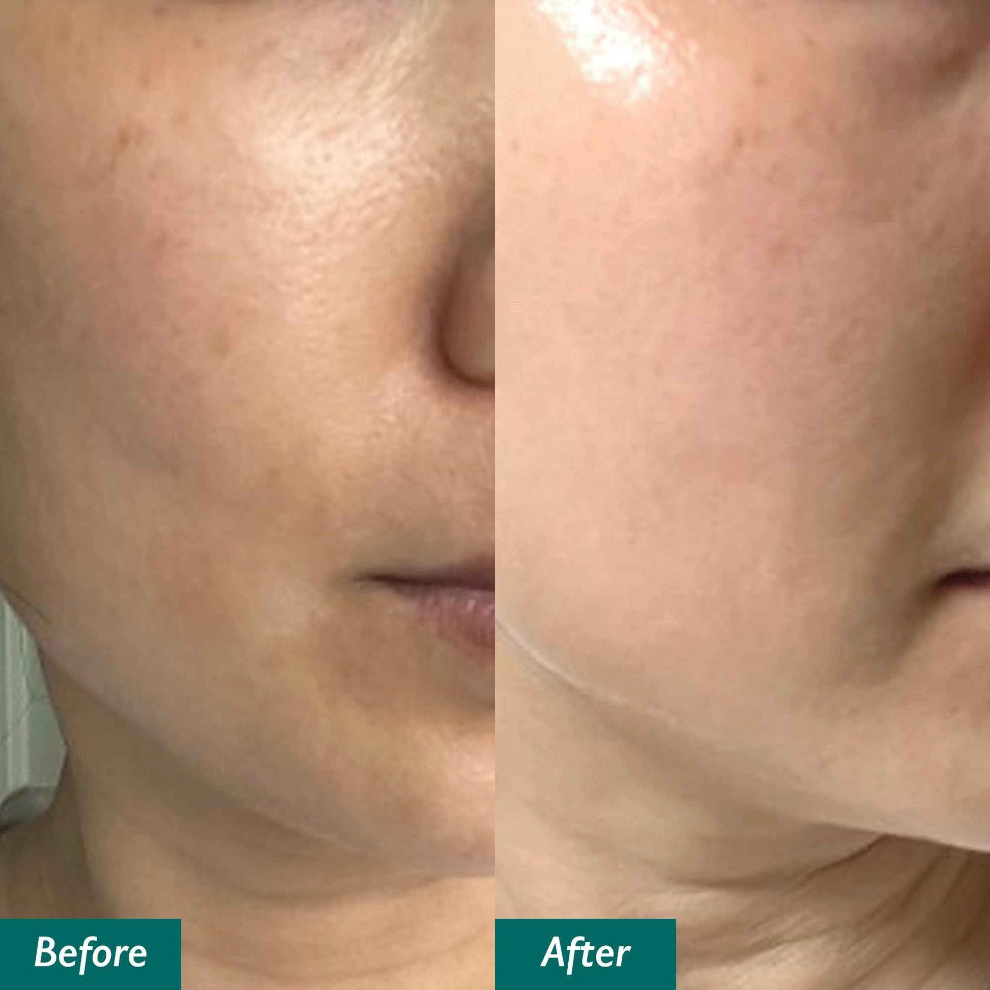 Genabelle Edelweiss Lifting Serum – Anti-Aging Formula with Edelweiss Extract, Niacinamide, Peptides for Firming, Hydration & Brightening – 1.35 fl.oz