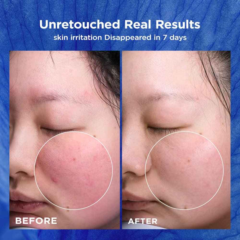 Medature PSL Repair Moisturizer II-Daily Moisturizer Face Cream with Ceramides for Dry & Sensitive Skin, Hydrates, Strengthens Skin Barrier, Calms Redness and Irritation, Anti-aging