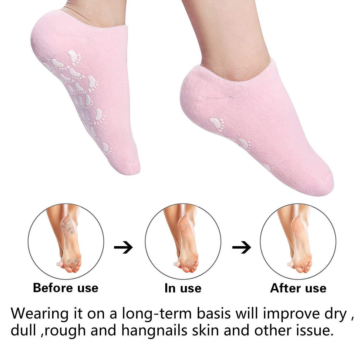 Moisturizing Socks Heel Gel Sock - Callus Rough Foot Care Treatment Soft Silicone Gel Lined Infused Lotion Spa Socks|2 Pairs Cotton Gel Sleeves for Repairing Softening Dry Cracked Feet Skins