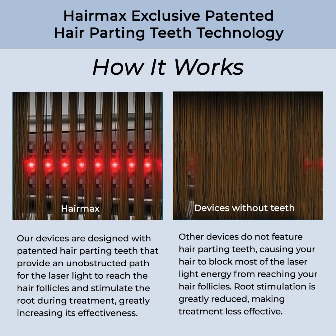 HairMax Ultima 9 Classic LaserComb (FDA Cleared) Hair Growth Device. Stimulates Hair Growth, Reverses Thinning, Regrows Denser, Fuller Hair. Targeted Hair Loss Treatment.