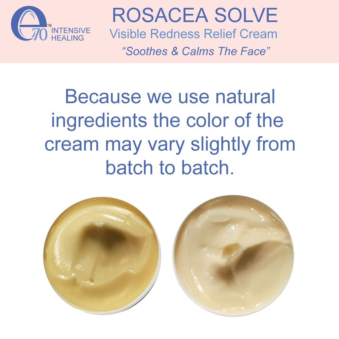 e70 Rosacea Solve - Redness Relief Cream - Face Moisturizer For Rosacea & Acne Prone Skin - Skin Care With Organic Ingredients, Almond Oil, Licorice and Chamomile Extracts - No Parabens (Pack of 2)