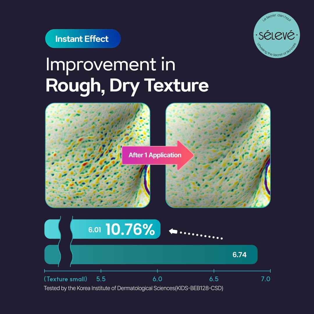 SELEVE Glow Caviar Bubble Toner – Hydrating & Glow Face Toner with Green Caviar Liposomal PDRN, Niacinamide, Panthenol & Ferulic Acid – for Sensitive & Dry Skin, Korean Skin Care (3.38 fl.oz / 100ml)