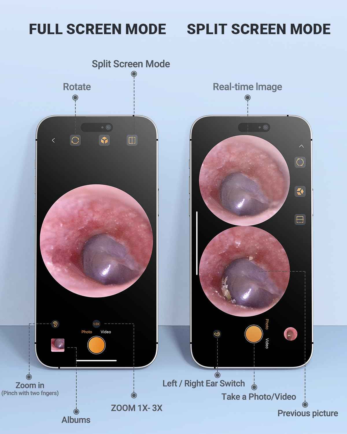 AnyScope HD Digital Otoscope, Video Ear Scope Otoscope with Light, Ultra Clear View Ear Camera with Ear Wax Removal Tools, Compatible with iPhone and Android Devices (Silver) ﻿