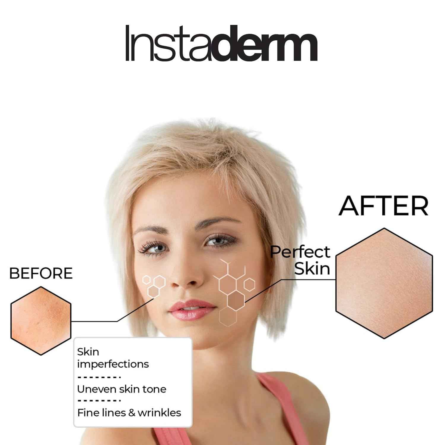 Glycolic Acid 15% Anti-Aging Wrinkle Cream- Reduces the Appearance of Fine Lines, Wrinkles, Age Spots, Dark Spots. Exfoliates, Smoothes Skin Texture, Tone & Improves Dull Looking Complexion.