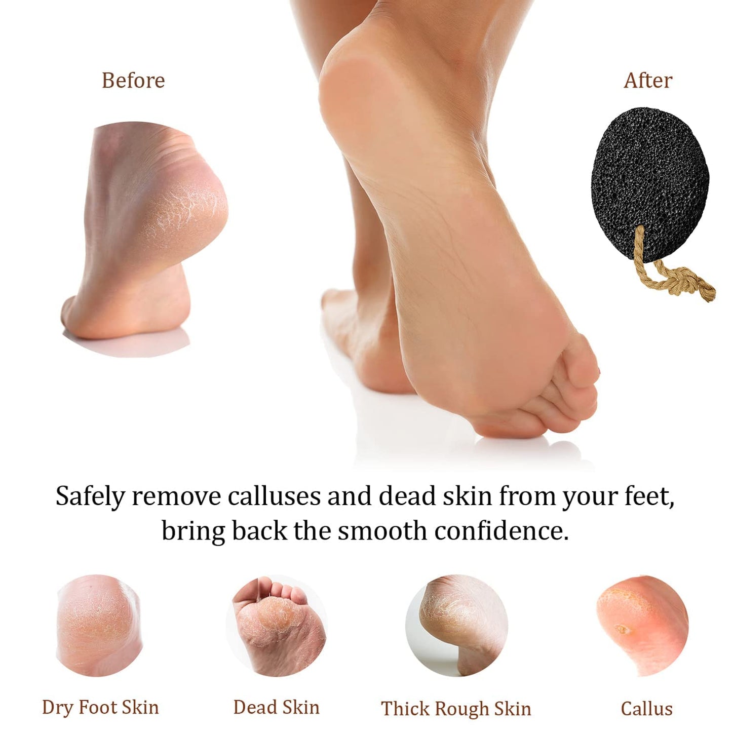 Pumice Stone - Natural Earth Lava Black - Callus/Corn Remover for Feet Heels and Palm - Pedicure Exfoliation Tool - Dry Dead Skin Scrubber - Health Foot Care