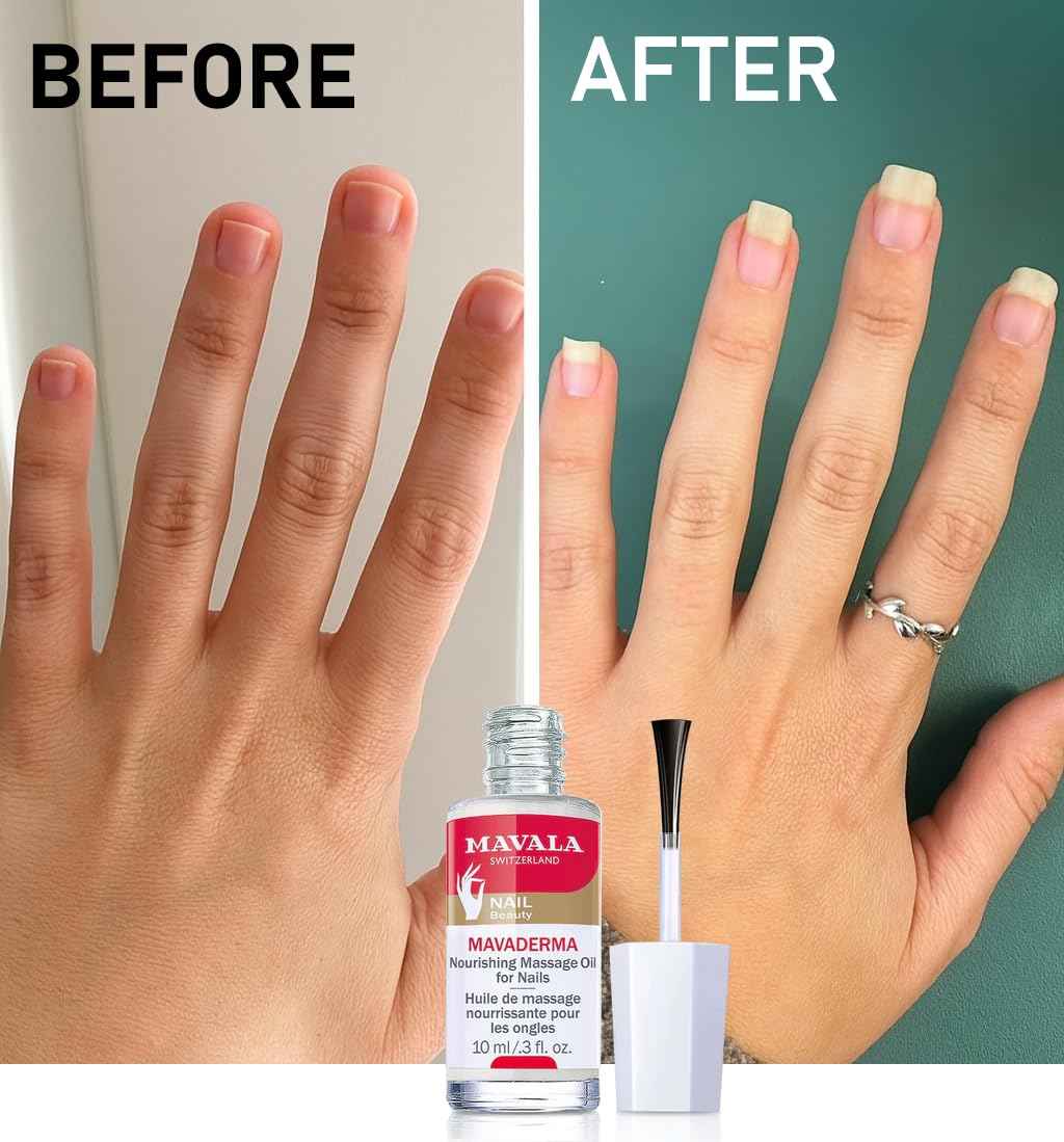 Mavala Mavaderma Nourishing Massage Oil for Nails, Nail Care, Nail Hardener, Cuticle Oil Nail Growth, Moisturizing & Healing Treatment for Cracked Nails & Rigid Cuticles (0.3 Ounce)