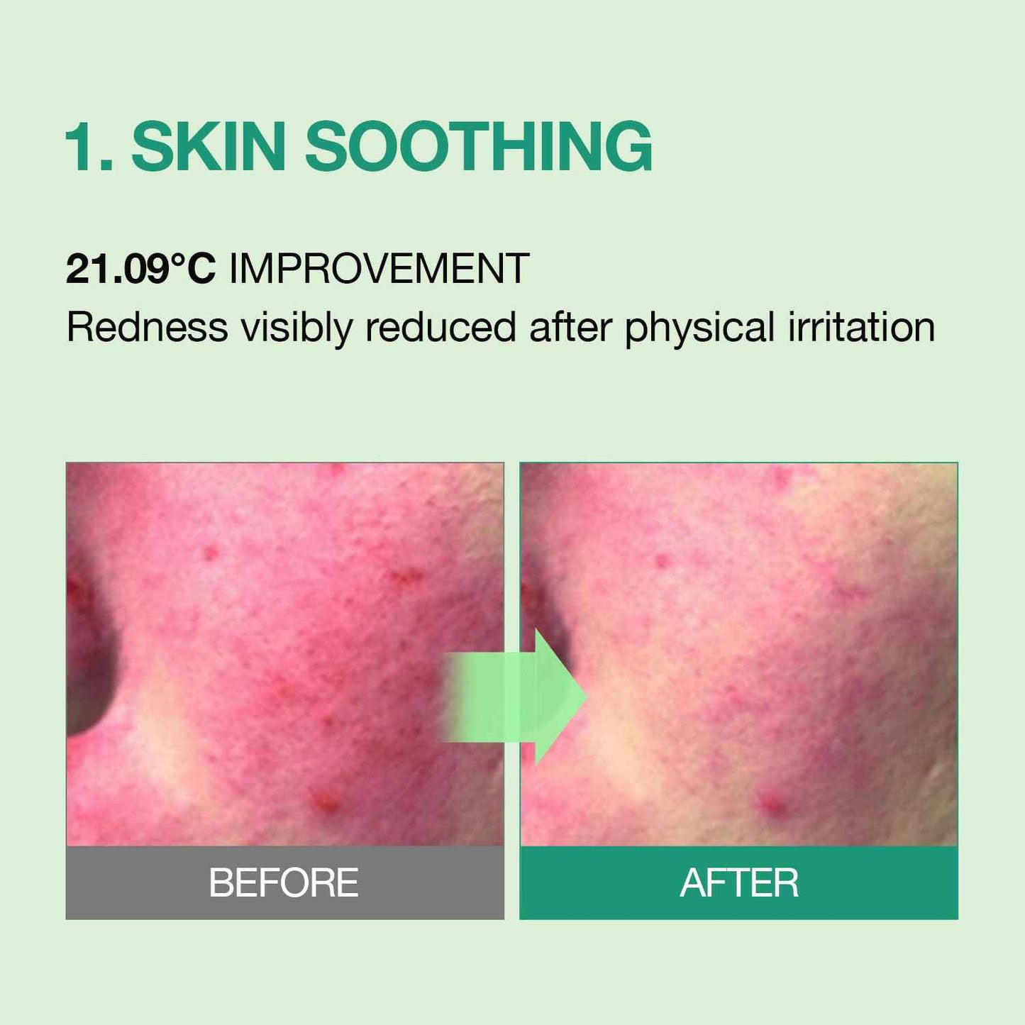 ESSENHERB Tea Tree Soothing In Calming Cream | Tea Tree Moisturizer | Calming Cream for Dry, Sensitive, All Skin Types, Korean Skincare (2.70oz * 2Pack)