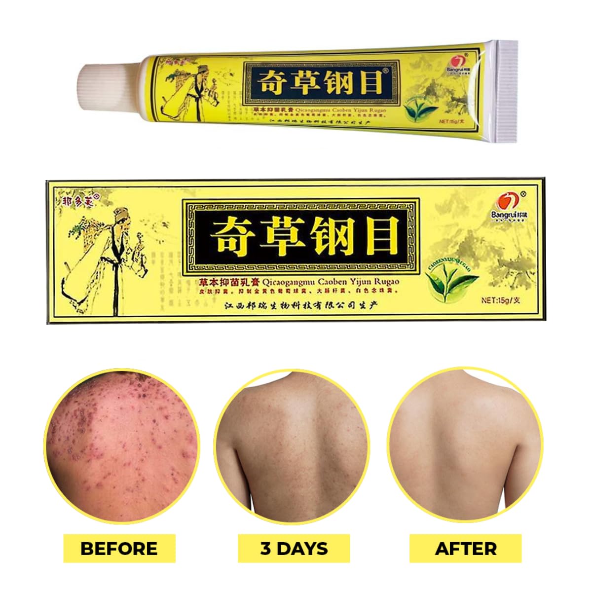 QICAOGANGMU Official Seller - Chinese Herbal Cream - Natural Relief for Skin Issues - Pack of 1