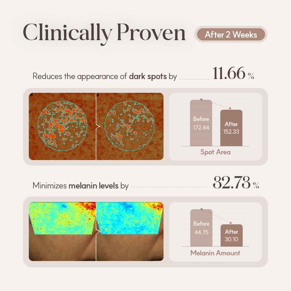 Lulubeu Mela Clinic Ampoule with NK Cell Technology, Skin Tone Care Serum with Tranexamic Acid, Glutathione & Bisabolol, 0.5 fl oz