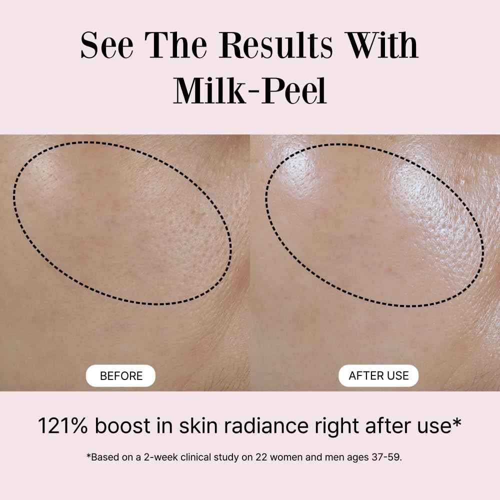 Simpleté Milkpeel Toner to Essence – Gentle Daily Exfoliating, Hydrating Toner for Smooth, Radiant Skin, Strengthens Moisture Barrier, Perfect for Sensitive Skin, Balanced, Healthy Glow, 200ml