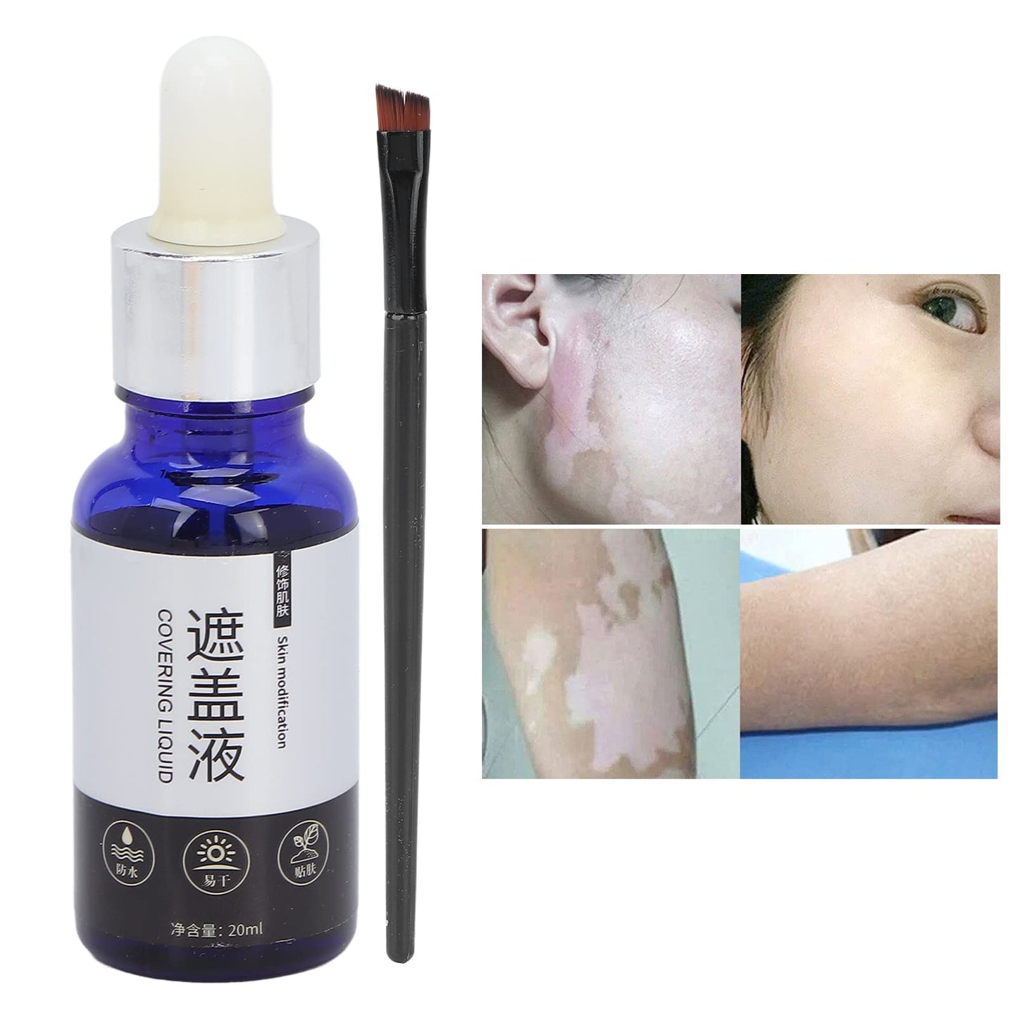 20ml Vitiligo Covering Liquid, White spot concealer, Waterproof Makeup Vitiligo Concealer Cosmetics for Face Body, skin tone concealer