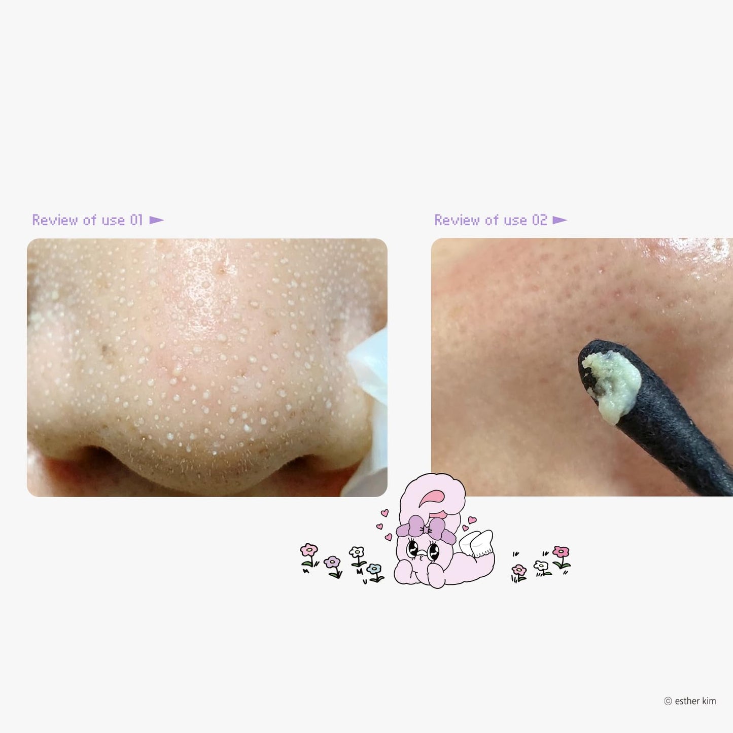 ilso Natural Mild Clear Nose Patch, Melt blackheads & Tighten Pores, 10 sheets (Esther Bunny Acrylic Key ring included) (PINK Esther Bunny Limited Edition 10 sheets + Acrylic Key Ring)