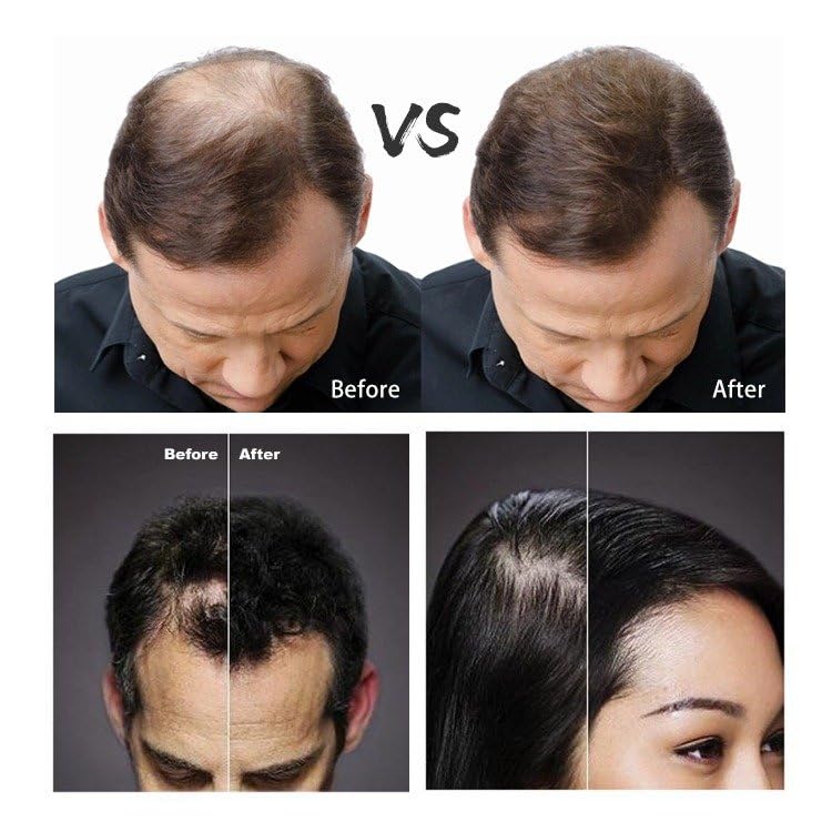 FIBR Hair Keratin Building Fibers for Thinning Hair - Dark Brown