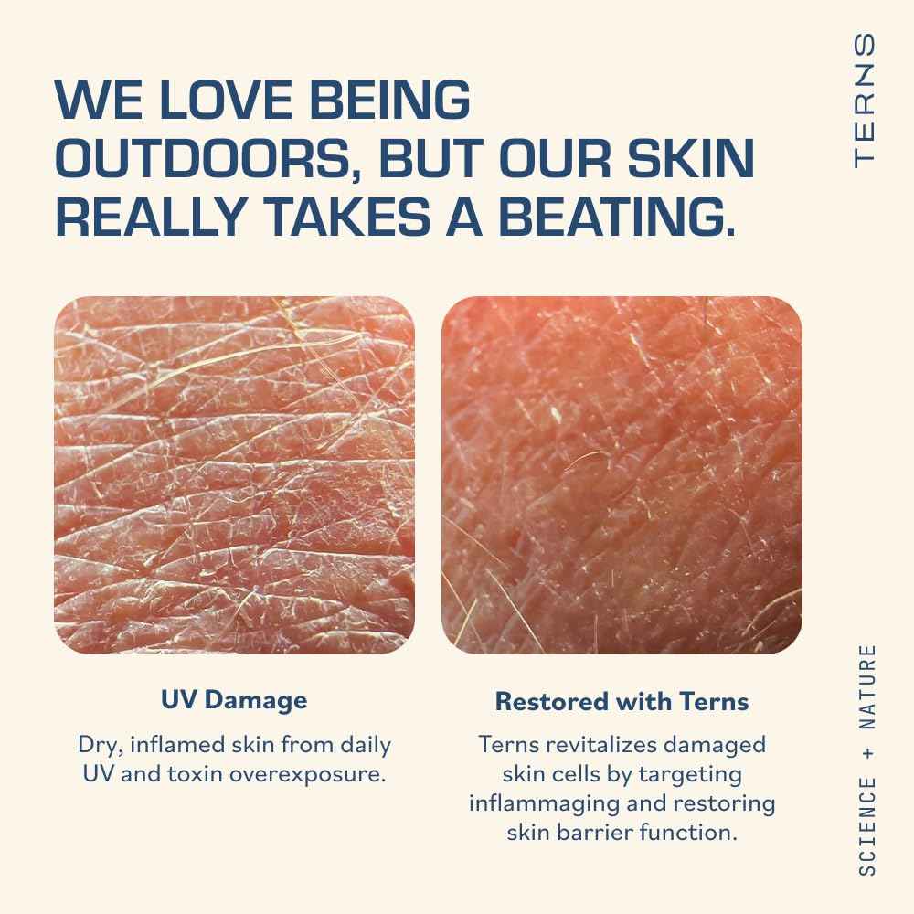 TERNS Everyday Lightweight Daily After Sun Moisturizer – Hydrating, Dermatologist Approved – Marine-Powered Skincare for Active Skin, Paraben Free 3.4 oz