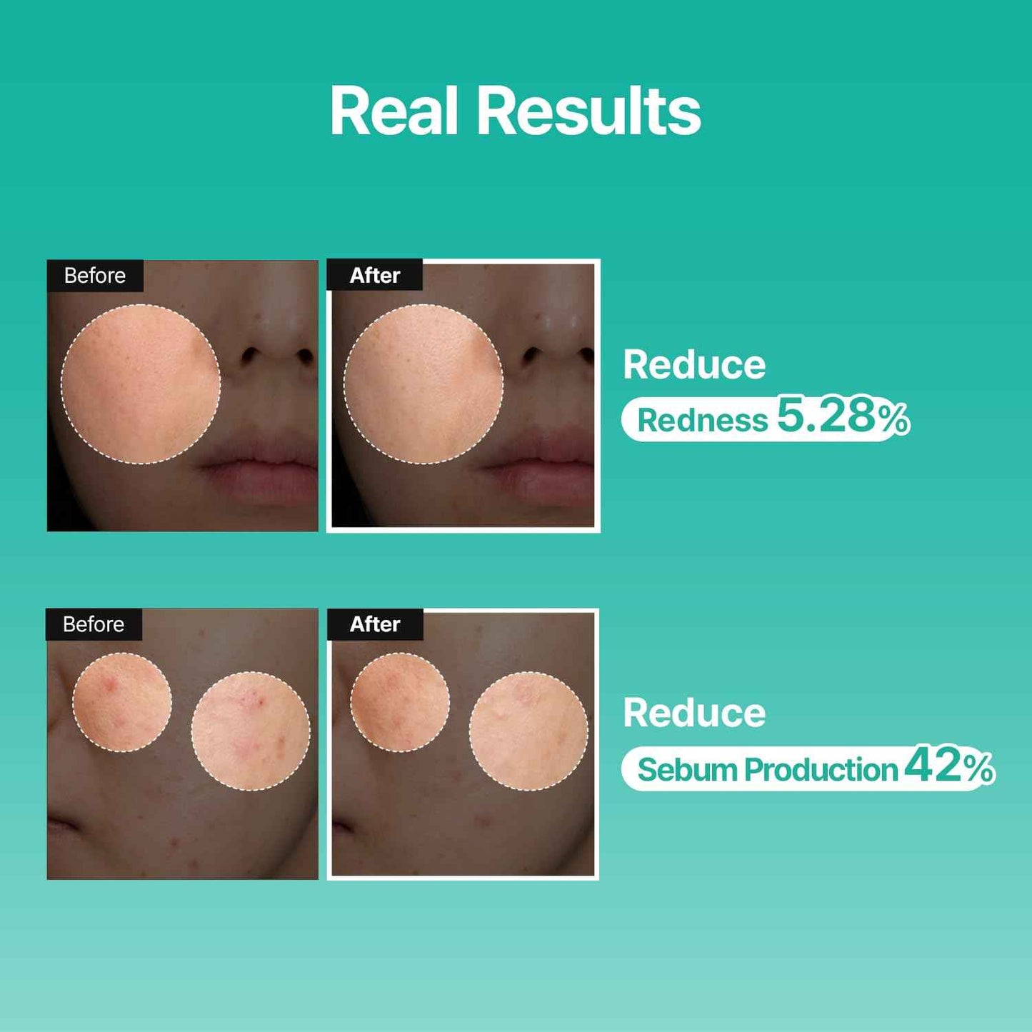 Meditherapy PDRN Skin Booster Serum – Centella PDRN & D-Panthenol for Redness Relief and Rejuvenation, Gentle Cica Facial Serum for Sensitive Care, Korean Skin Care, 100 ml (3.38 fl.oz)