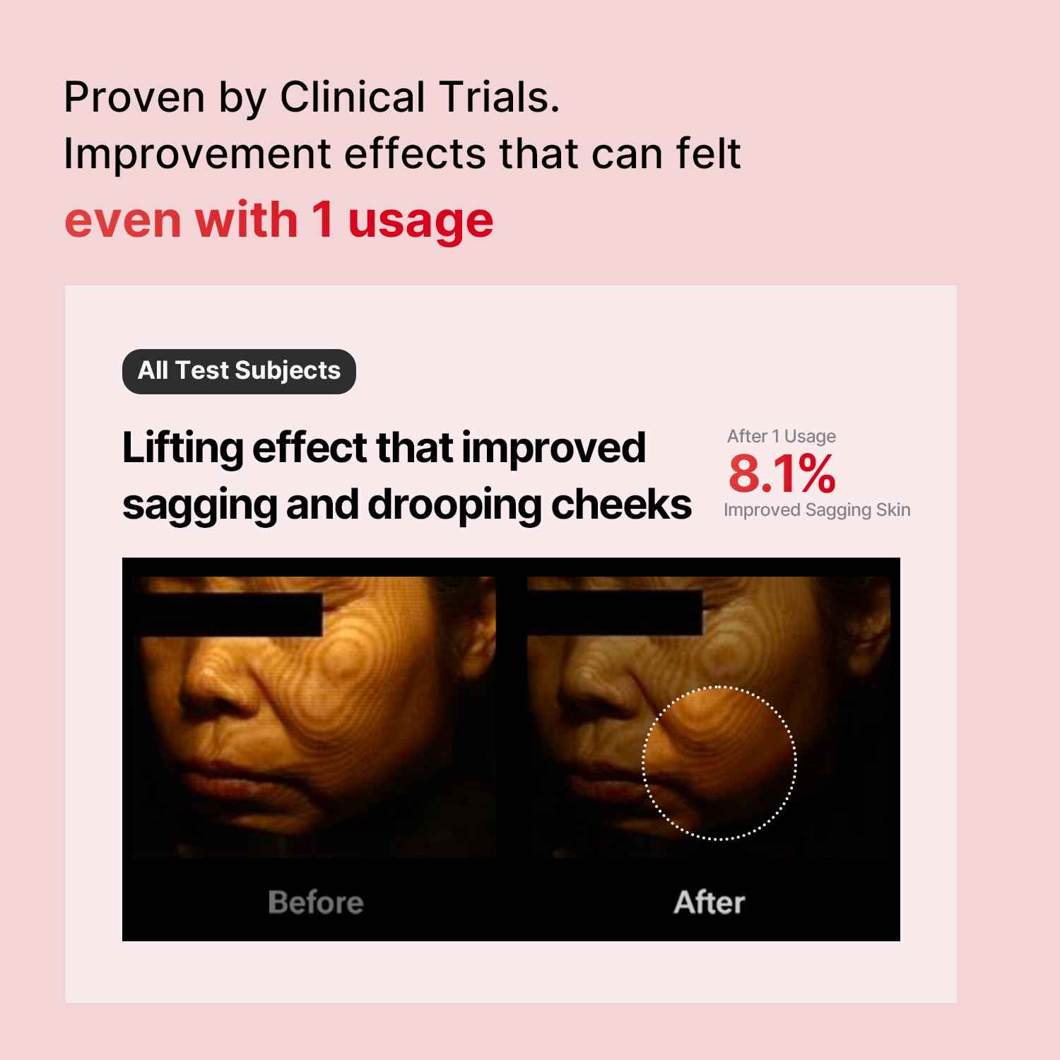 Shumage Gold Seal Lifting Cream+Device - Moisturizer Face Lift Cream, Hydrating & Tightening for Sagging Skin - Korean Face Moisturizer - Microcurrent Facial Device for Radiant Glow Skin - 1.69 Fl. Oz