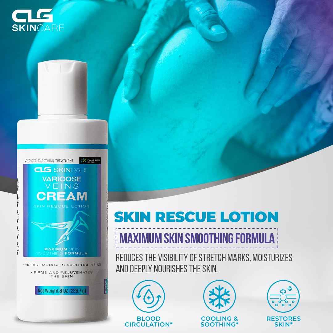 CLG Skincare Varicose Veins Cream - Skin Rescue Lotion for Smoother, Healthier Legs - Advanced Formula for Varicose Veins Improvement, Circulation & Skin Firming, Plant-Based Ingredients, 8 oz (1)