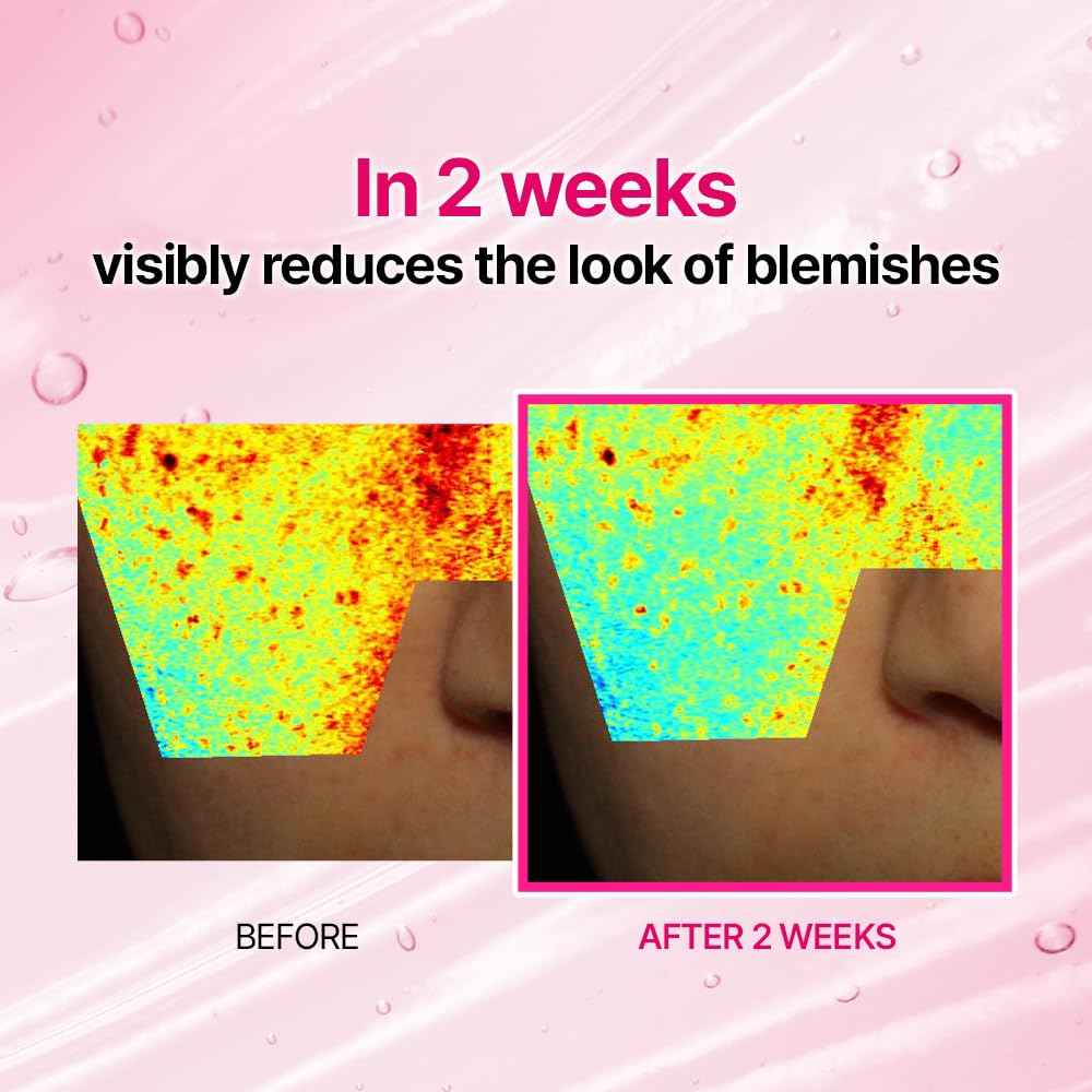 ISOI Brightening Serum with Rose PDRN, Advanced Spot Correcting Formula for Uneven Skin Tone and Radiance, Korean Skincare (1.18 fl.oz, 35ml)